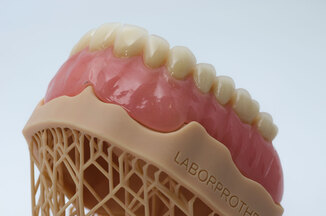 ¿Qué son las prótesis dentales removibles?