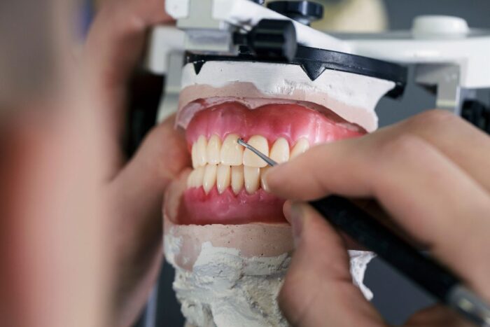 Prótesis dental completa - Laborprothesis