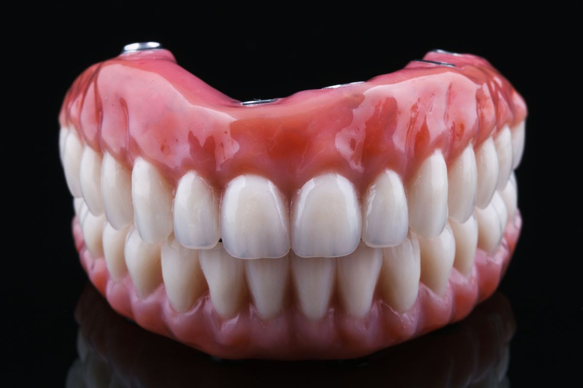 Tipos de prótesis dentales Todo lo que necesitas saber - Laborprothesis
