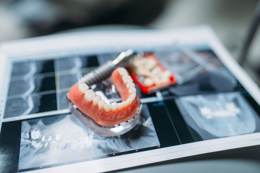 Ventajas y desventajas de las prótesis dentales - Laborprothesis
