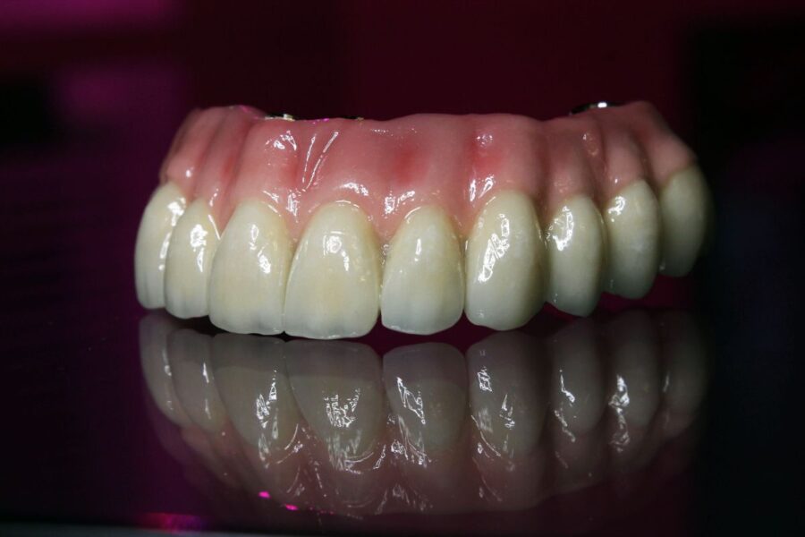 Prótesis dentales removibles sin ganchos - Laborprothesis