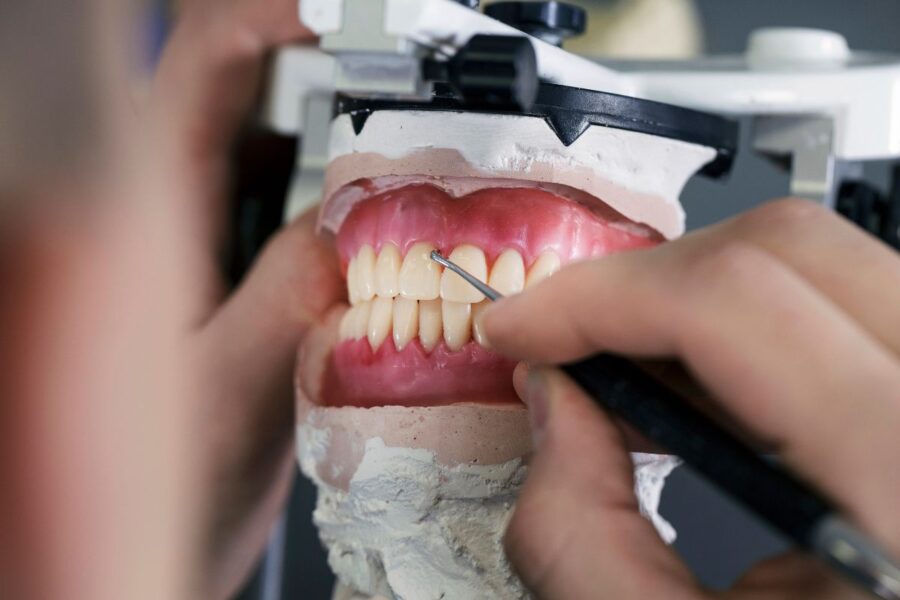 Gomas de brackets ¿Para qué sirven en ortodoncia?