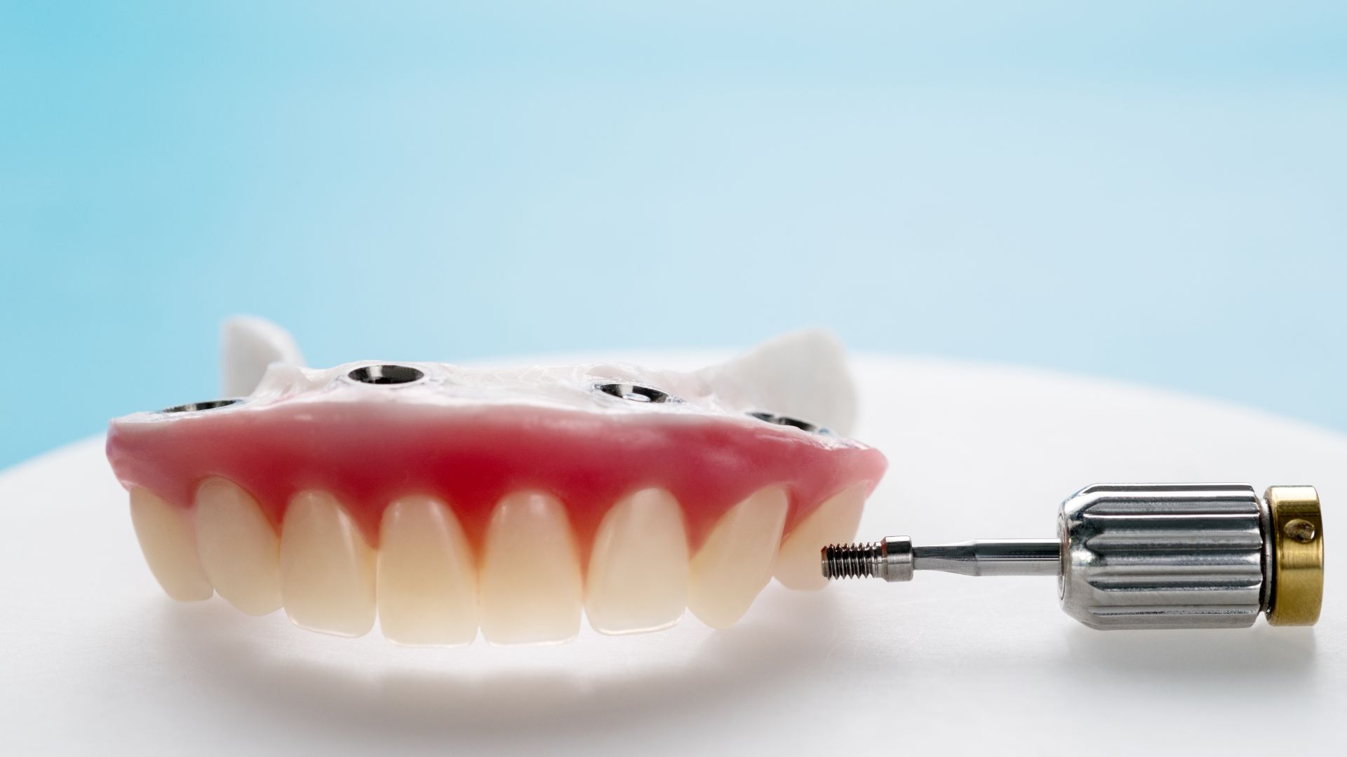 Sobredentadura sobre implantes dentales: ¿En qué consiste?