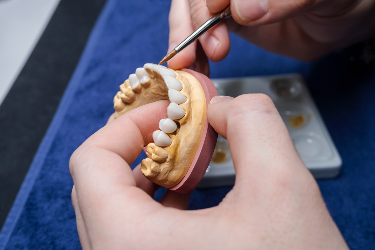 ¿Cuánto duran las prótesis dentales?