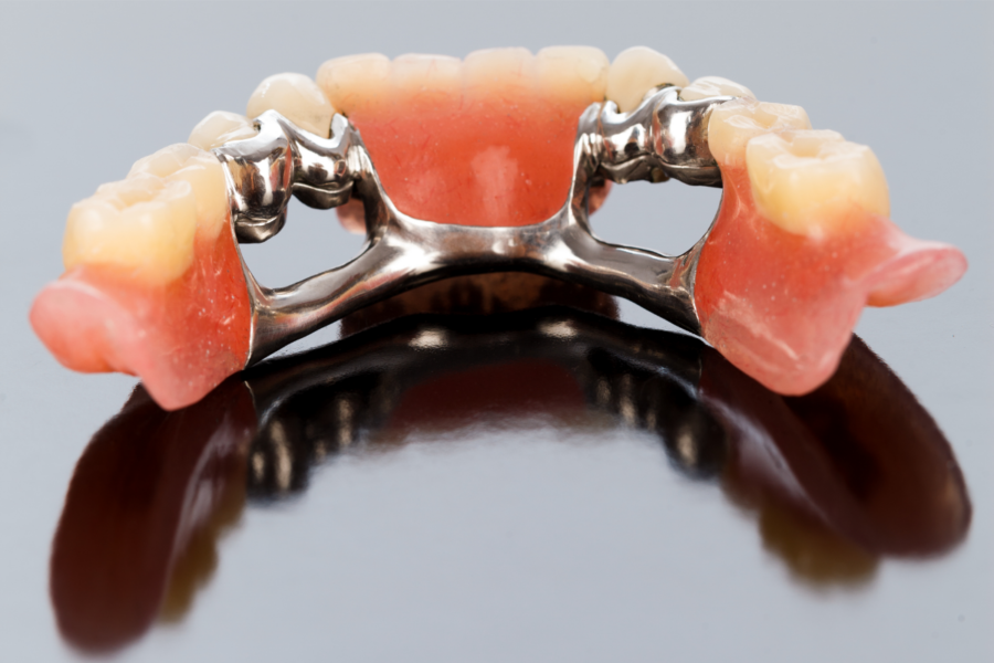 Todo lo que necesitas saber sobre las prótesis dentales esqueléticas - Laborprothesis